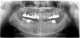 Thumbnail Panoramaaufnahme